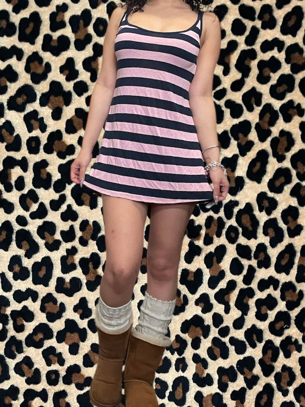 abercrombie striped mini dress